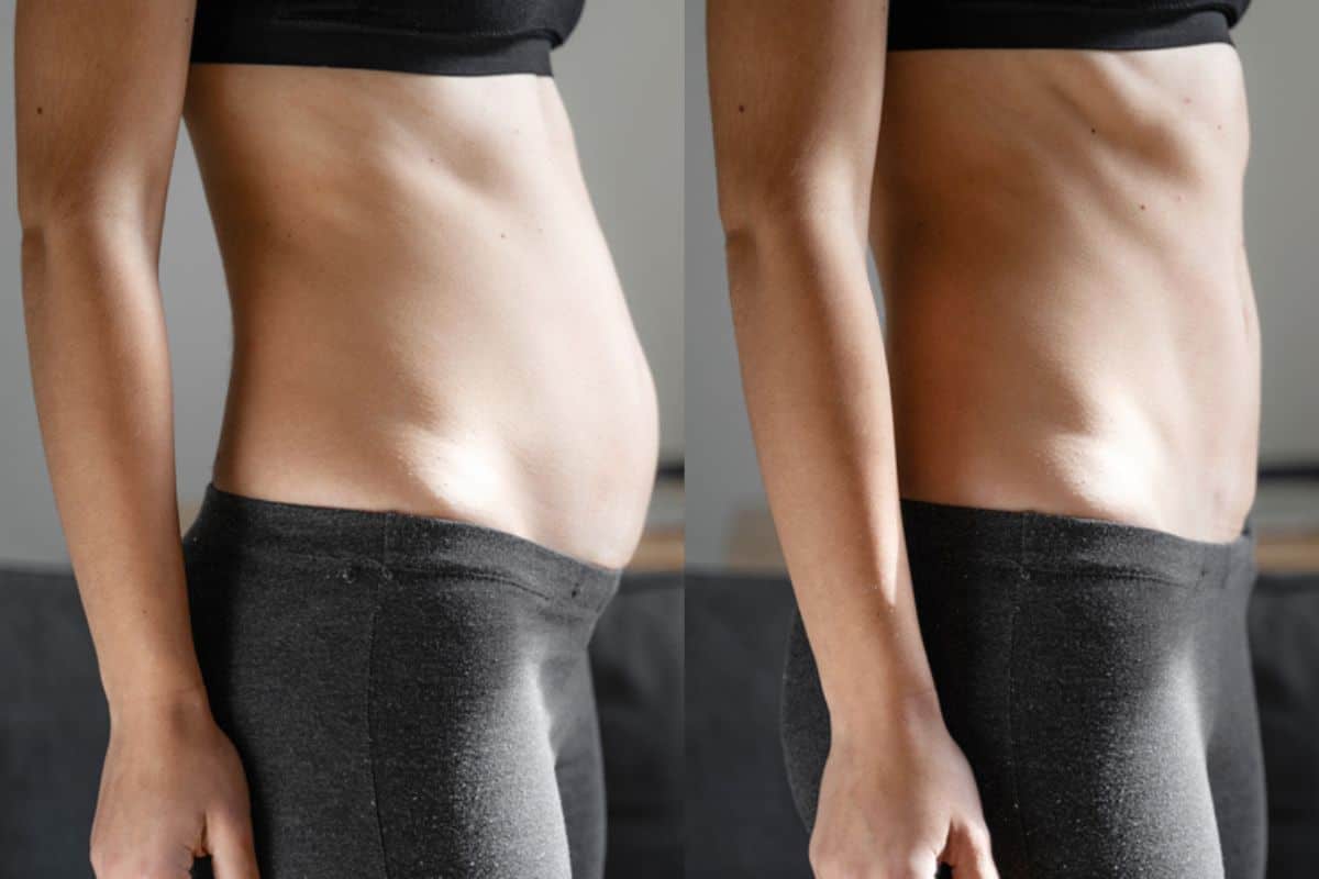 Post-Pregnancy: What Happens to Your Abdominal Muscles After Birth Dorchester