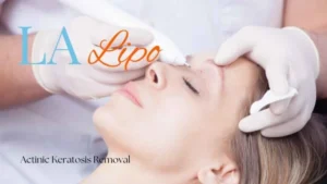 Woman receiving Actinic Keratosis Removal Treatment Dorchester