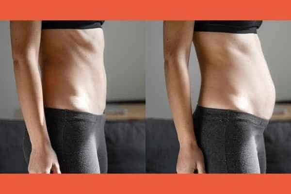 LA-EMS Body Sculpting results Dorchester