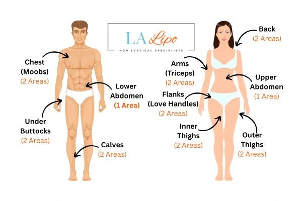 LA LIPO Cryolipolysis Areas Dorchester