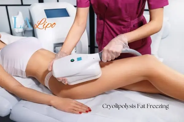 Woman receiving coolsculpting Dorchester treatment on her thighs