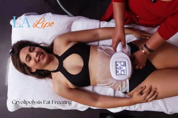 woman getting cryolipolysis Dorchester
