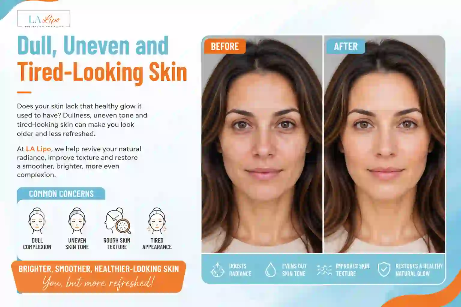 Sign #5: Dull, Uneven and Tired-Looking Skin Dorchester