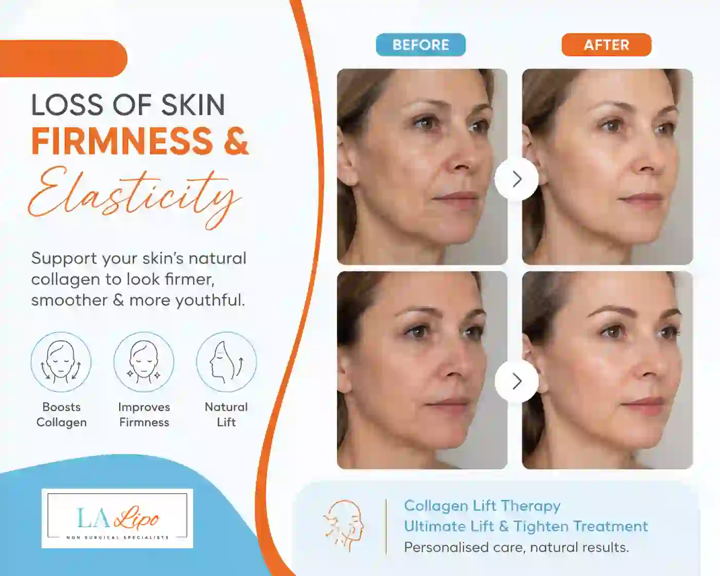 Sign #7: Loss of Skin Firmness and Elasticity Dorchester