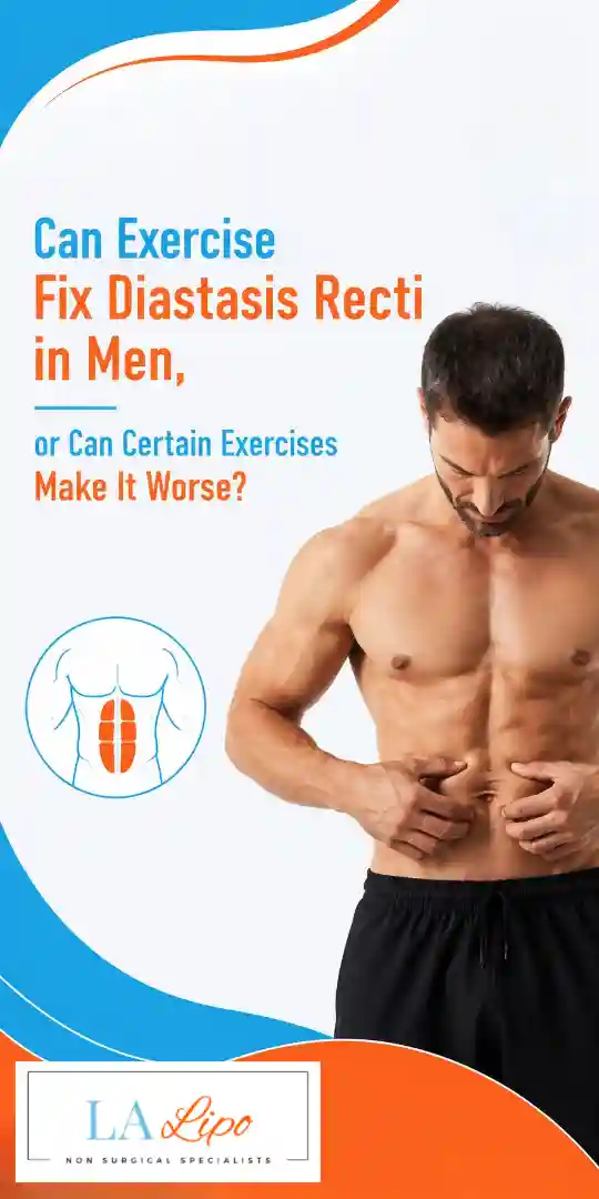 Can Exercise Fix Diastasis Recti in Men, or Can Certain Exercises Make It Worse Dorchester?